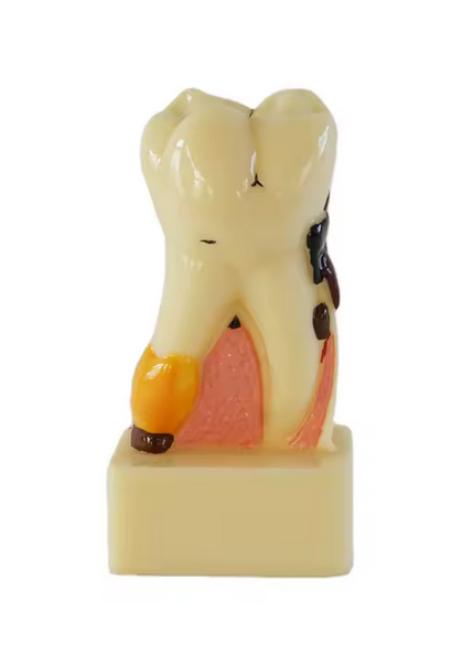 Molar demonstrativ patologie HST C17